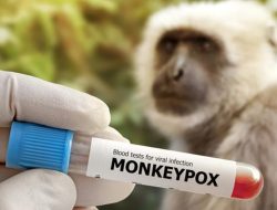 Mengenal Apa Itu Cacar Monyet, Gejala serta Cara Pencegahannya